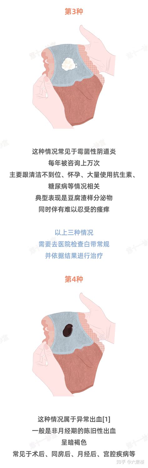 精斑是什么 精斑是什么颜色啊