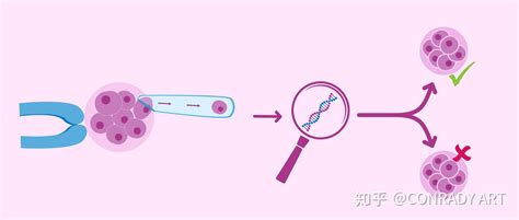 孕激素高是什么原因造成的 怀孕激素高是什么原因造成的