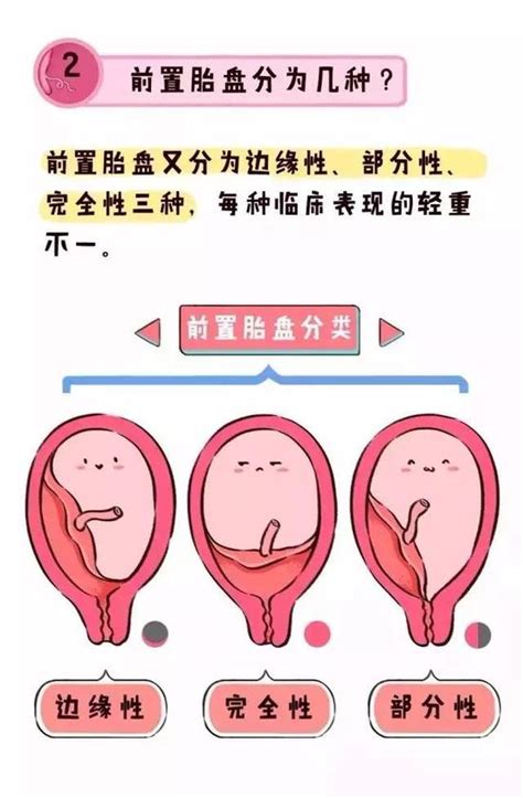 排卵期出血怎么治疗 排卵期出血怎么治疗才会好